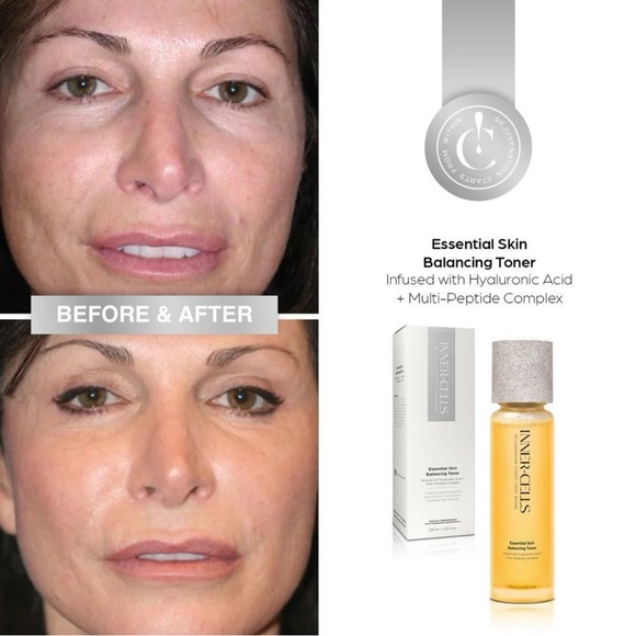 Inner-Cells Gold Infused Skin Balancing Toner ~ Retail $130 - Picture 3 of 3
